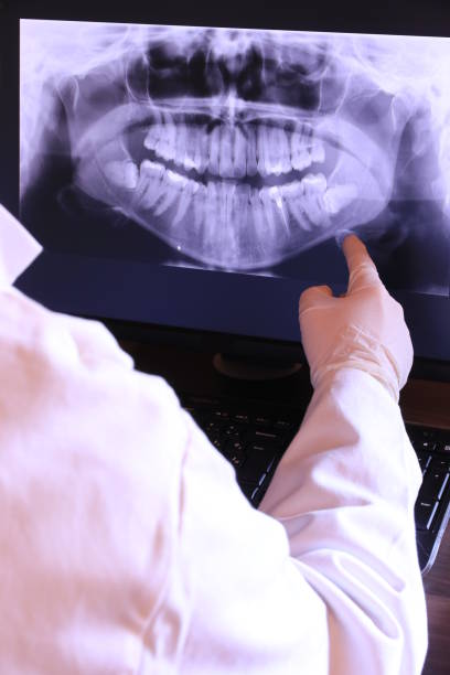 Best Emergency Tooth Extraction in Country Walk, FL