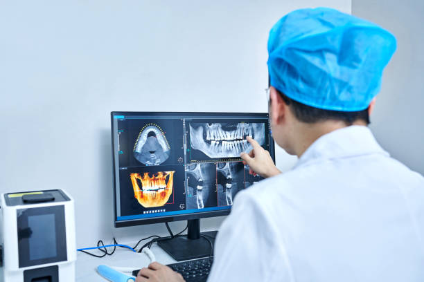 Best Emergency Tooth Extraction in Country Walk, FL